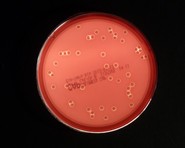 plate with beta-hemolytic colonies of staphylococcus aureus